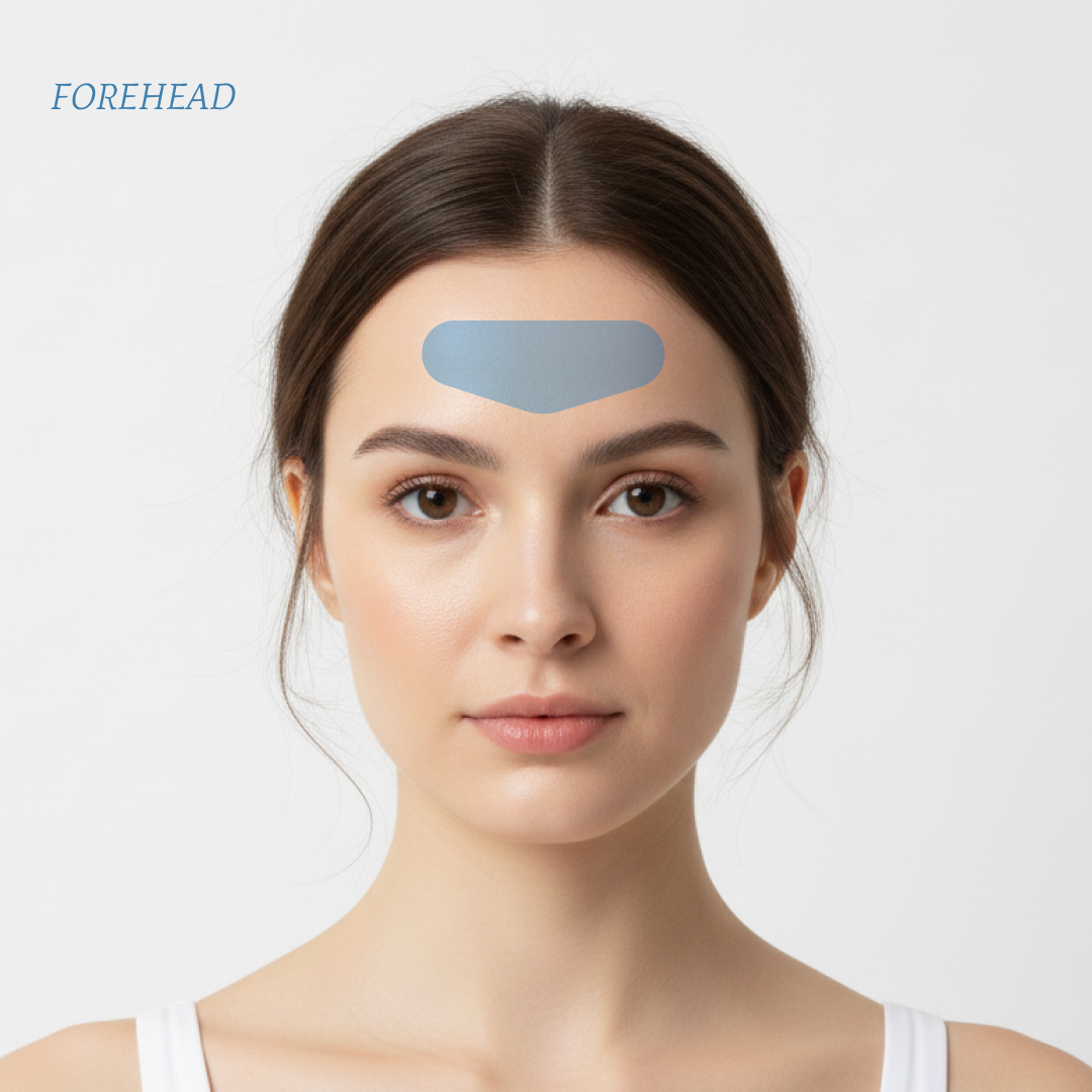 FOREHEAD LIFTING