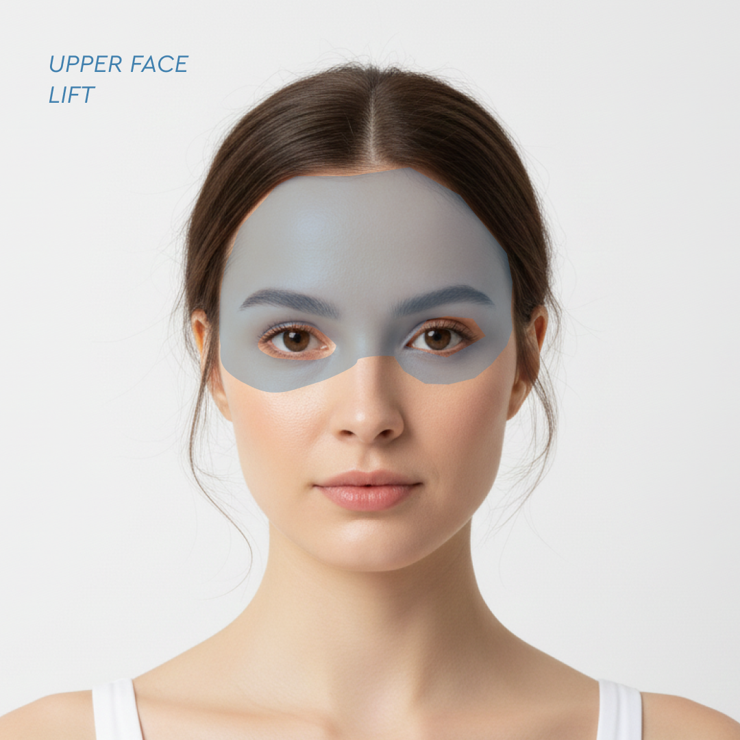 UPPER FACE LIFT