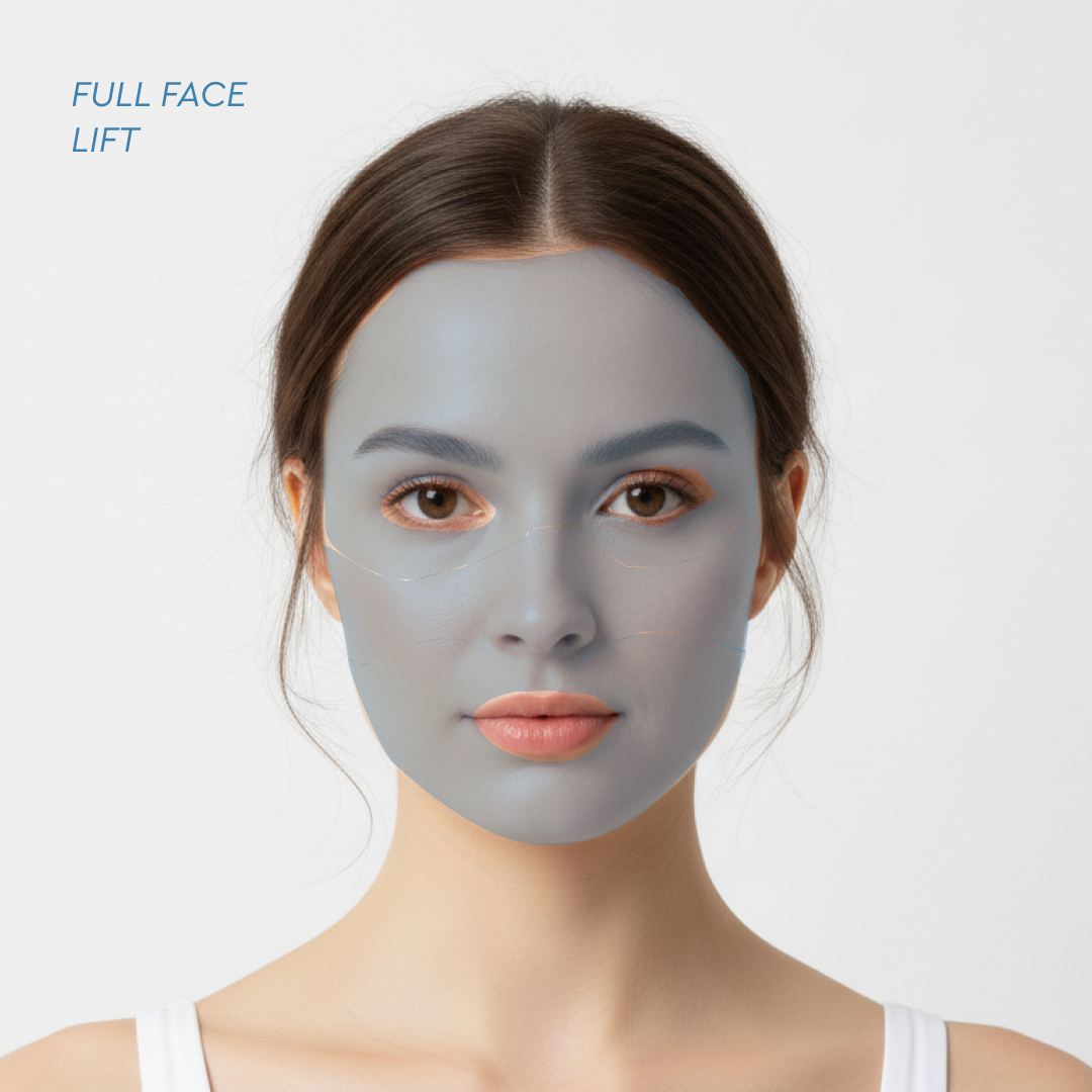 FULL FACE LIFT