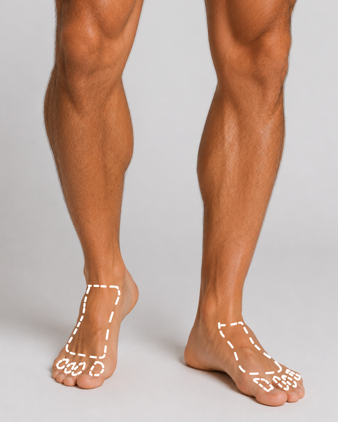 TOES + TOP OF FEET