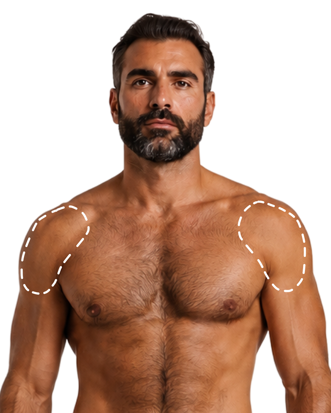 SHOULDERS