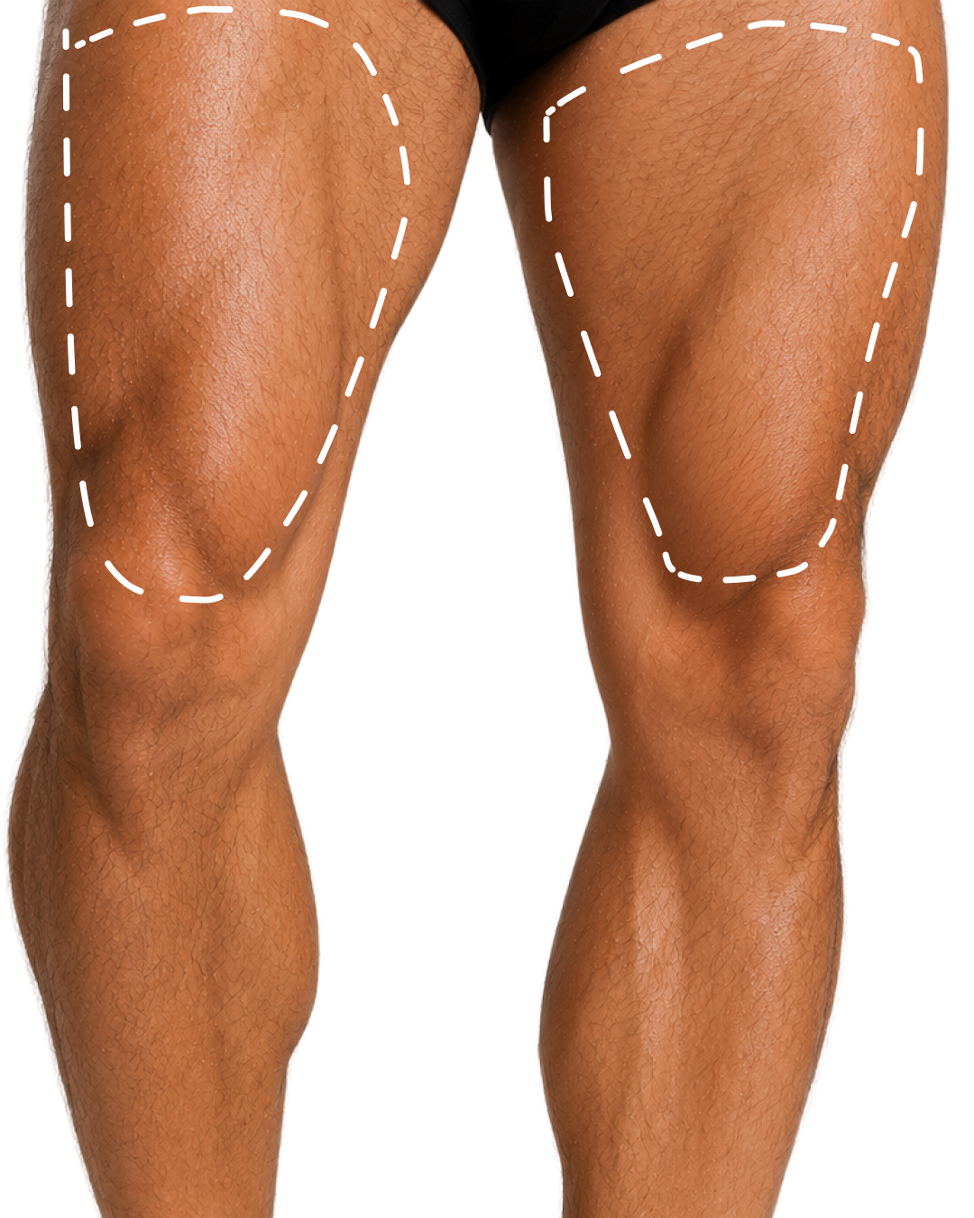 SHINS ( HALF LEGS )