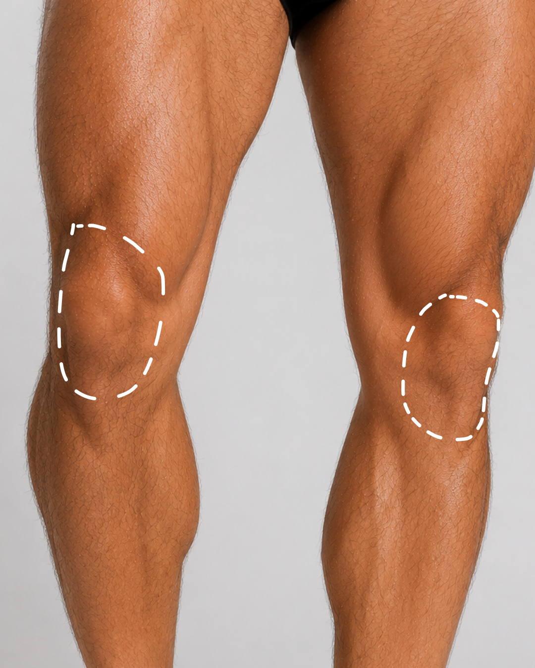 KNEES
