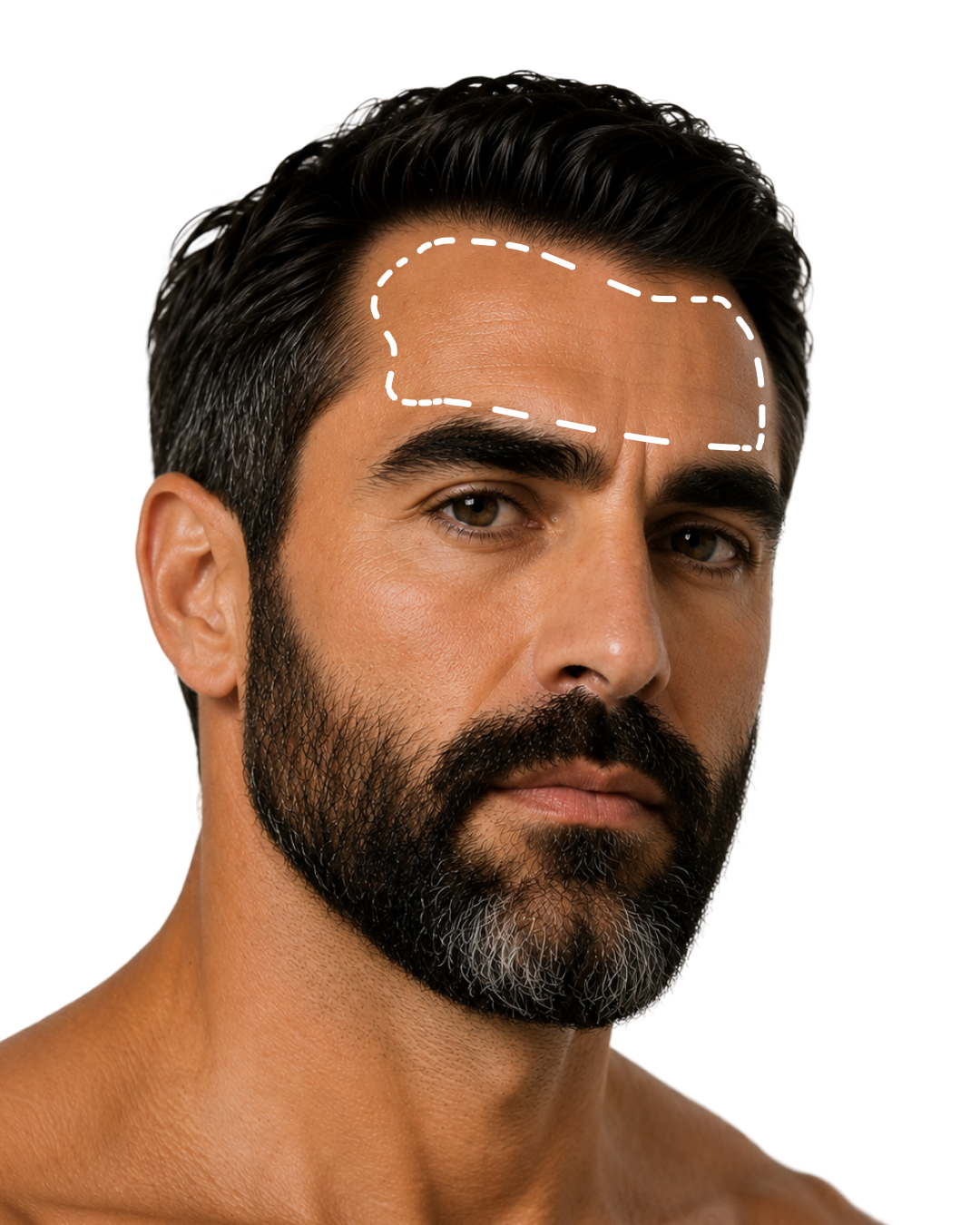 FOREHEAD AREA