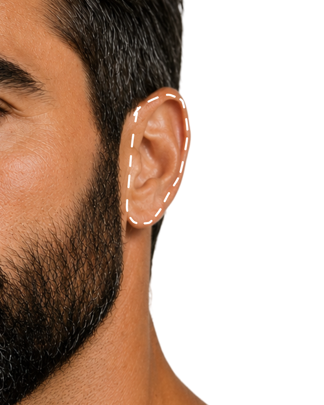 OUTER EAR AREA