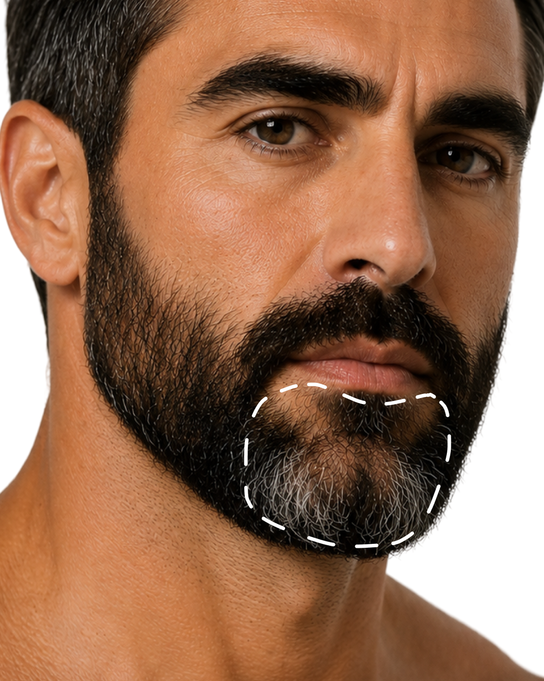 CHIN