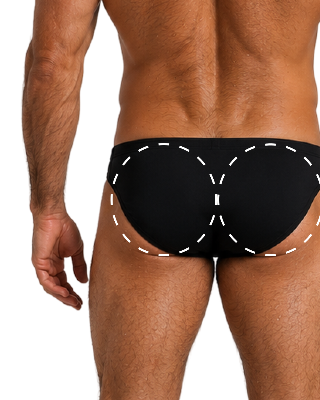 BUTTOCKS