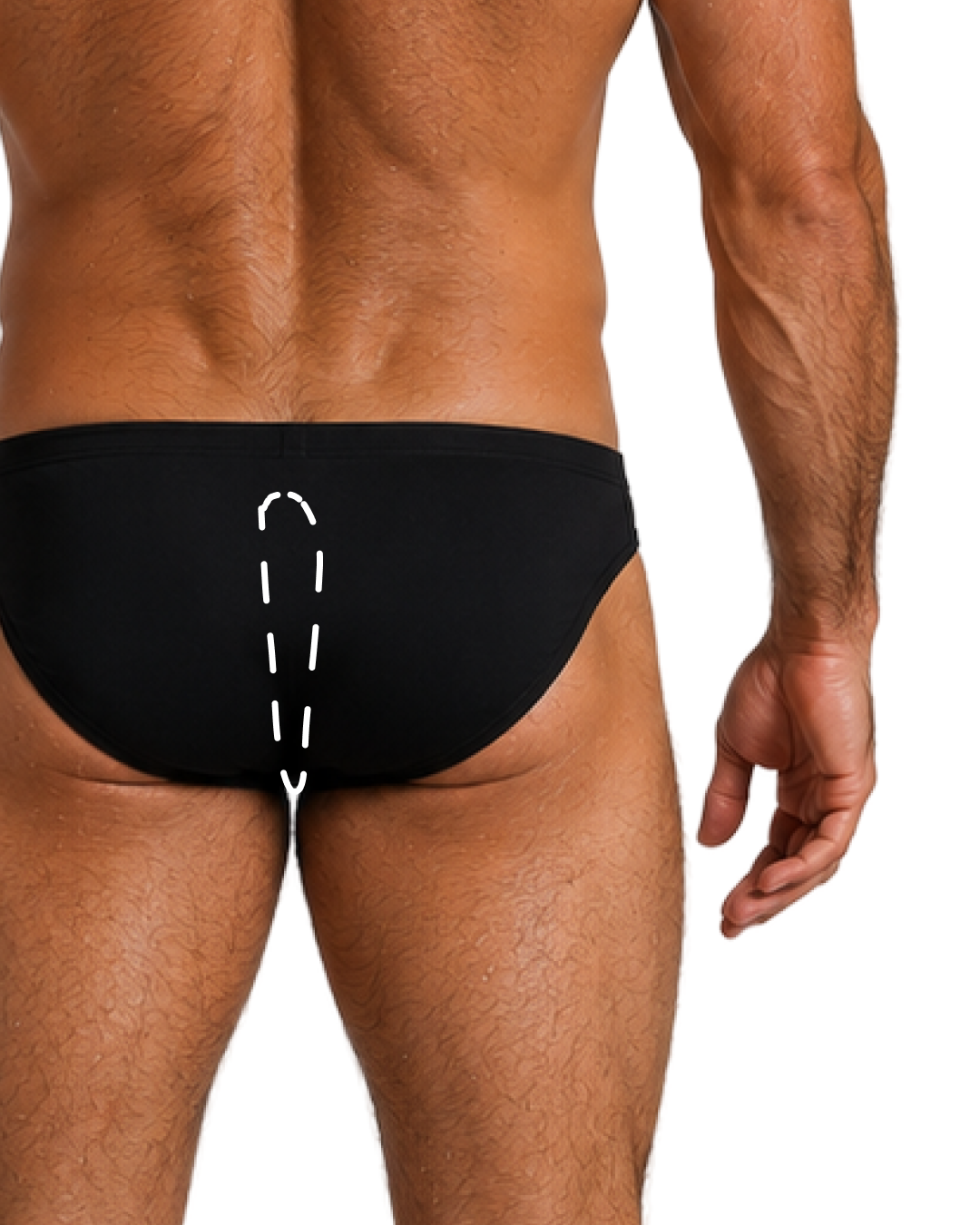 ANUS AREA
