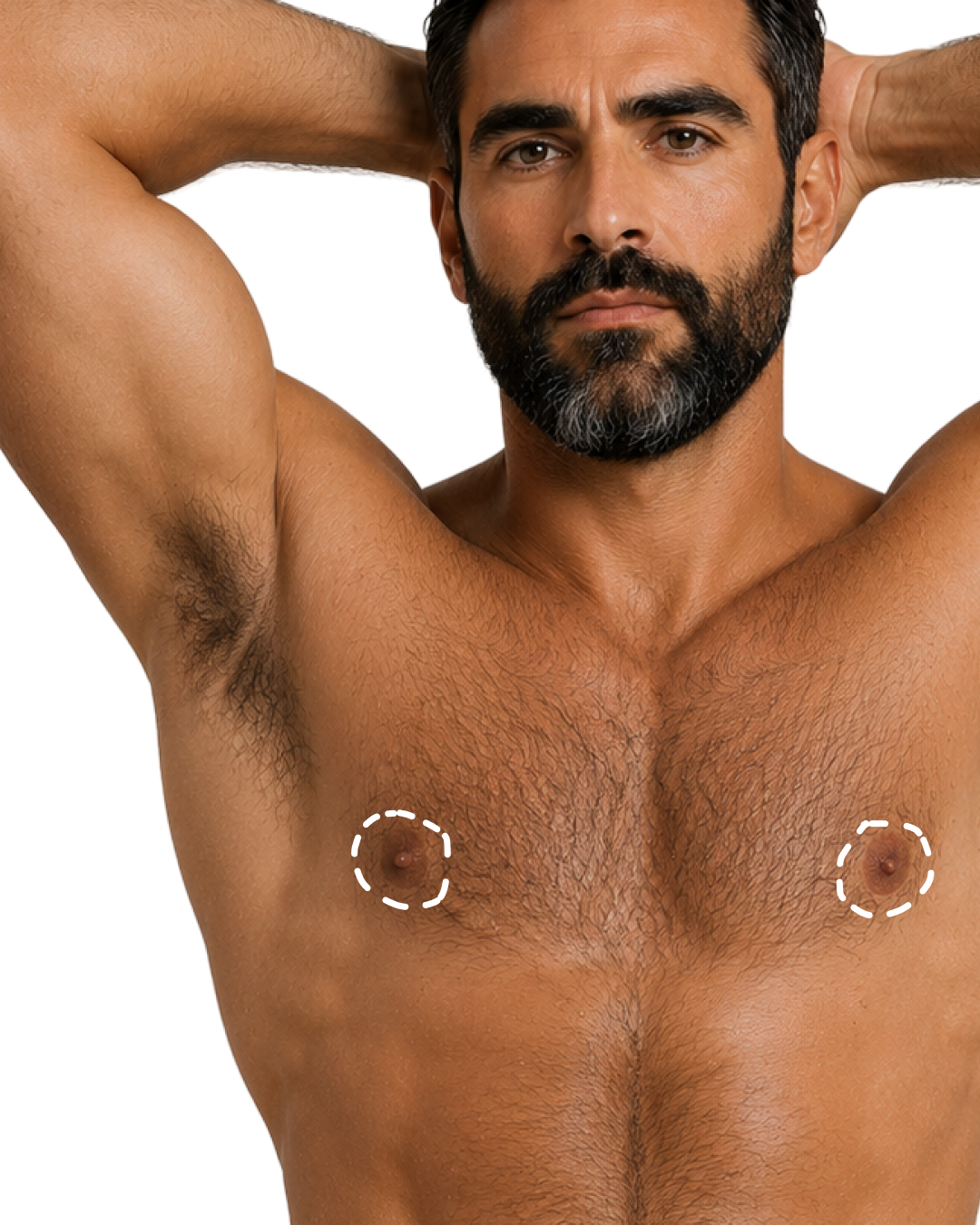 AREOLES