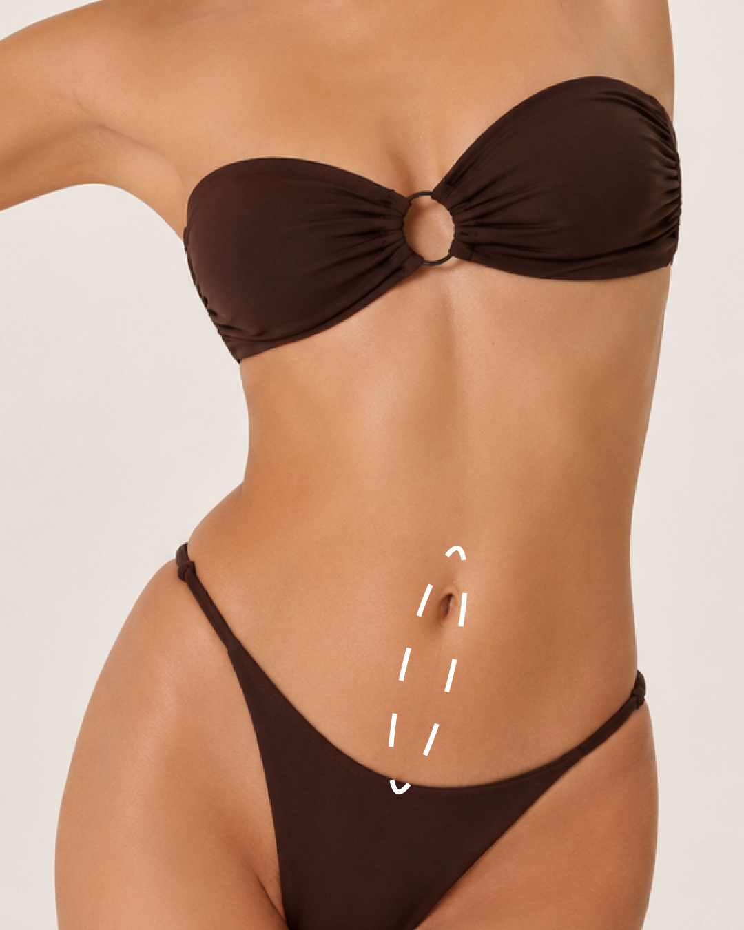 WHITE LINE STOMACH 