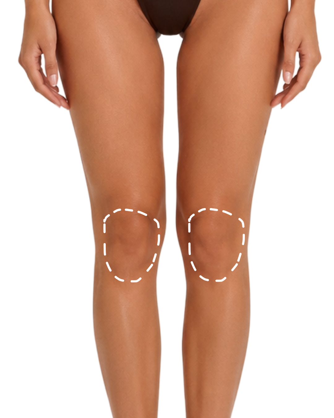 Knees