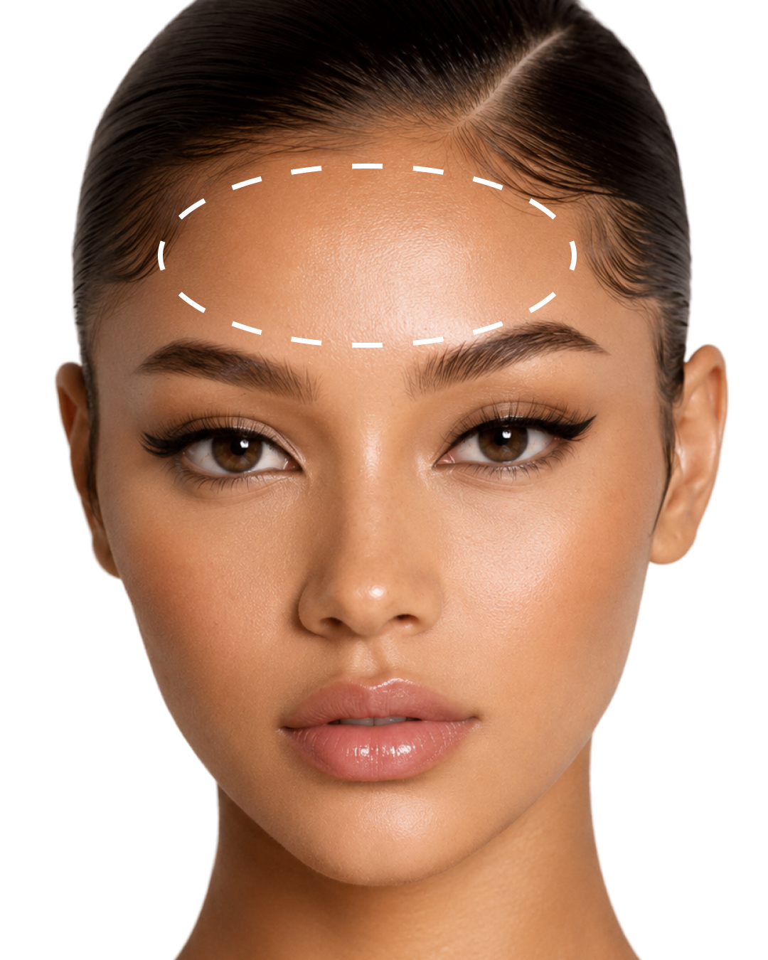 Forehead